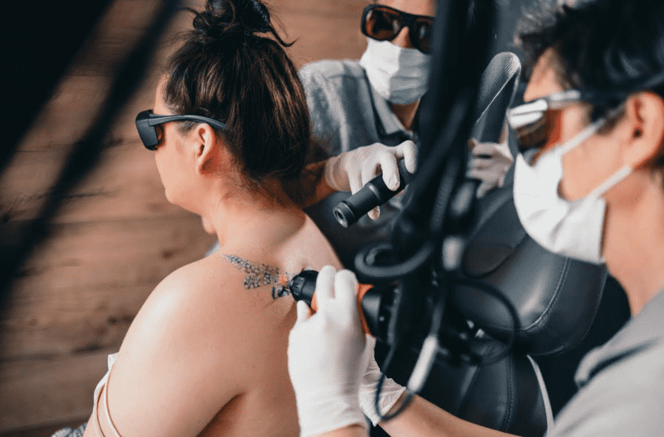 Bild: Tattooentfernung per Laser