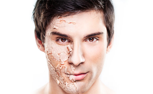 Trockene Gesichtshaut bei Männern Trockene Gesichtshaut bei Männern